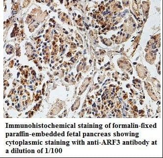 Polyclonal Rabbit anti-Human ARF3 Antibody (aa2-181, IHC, WB)
