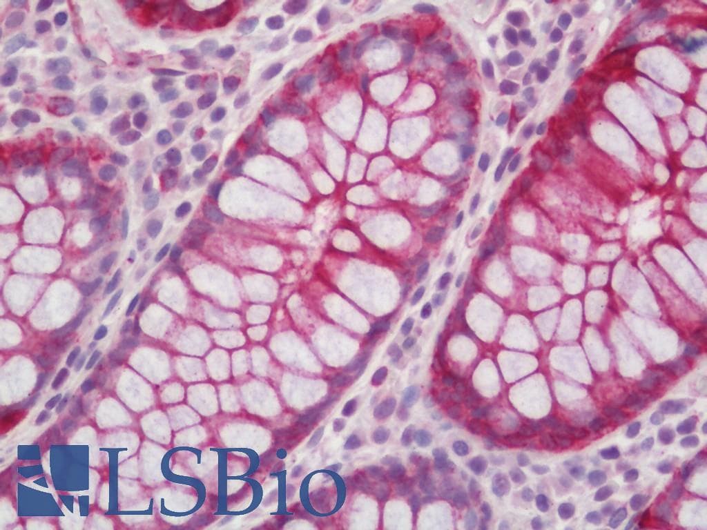 IHC-plus™ KRT8 / CK8 / Cytokeratin 8 Antibody (aa41-90)