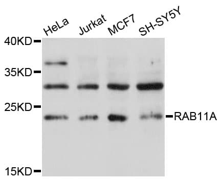 Polyclonal Rabbit anti-Human RAB11A Antibody (IHC, IF, WB)