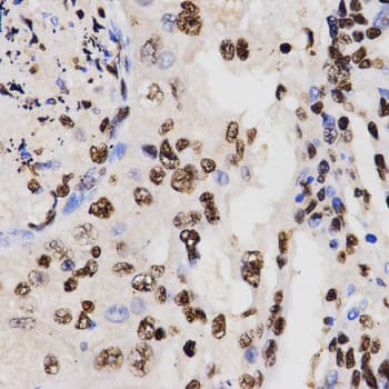 Histone H3 Antibody (Dimethyl-Lys27)