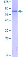 Human GART / GARS Protein (Recombinant GST)