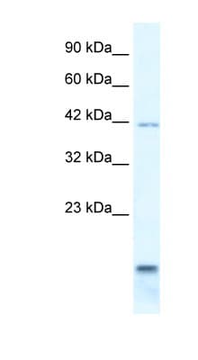 P2RX6 / P2X6 Antibody (aa66-115)