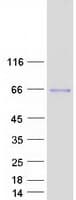 Human Spastin Protein (Recombinant Myc-DDK (Flag))