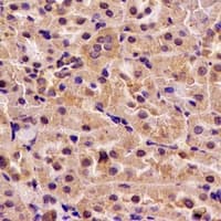 H6PD / G6PDH Antibody