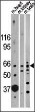 IHC-plus™ ACTRIIB / ACVR2B Antibody (aa1-30)