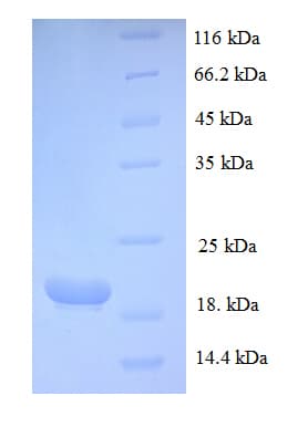 Human PTHLH / PTHRP Protein (Recombinant His)