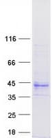 Human TMEM231 Protein (Recombinant Myc-DDK (Flag))