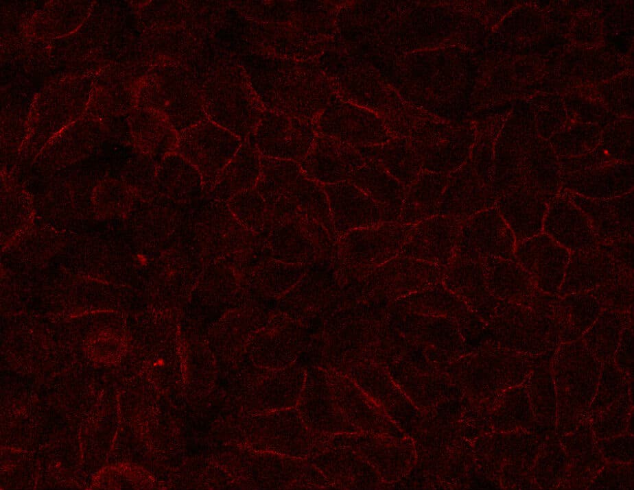 Polyclonal Rabbit anti-Human CDH1 / E Cadherin Antibody (IHC, IF, WB)