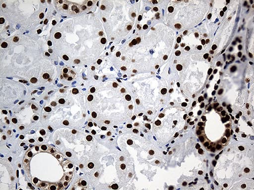 Monoclonal Mouse anti-Human PTBP3 / ROD1 Antibody (clone OTI5G7, aa300-552, IHC, WB)
