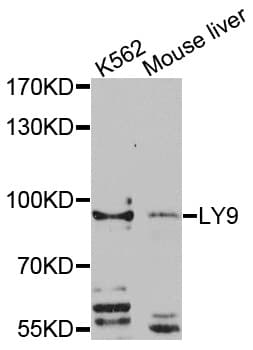 Polyclonal Rabbit anti-Human LY9 / CD229 Antibody (WB)