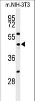 CDC25C Antibody (aa114-142)