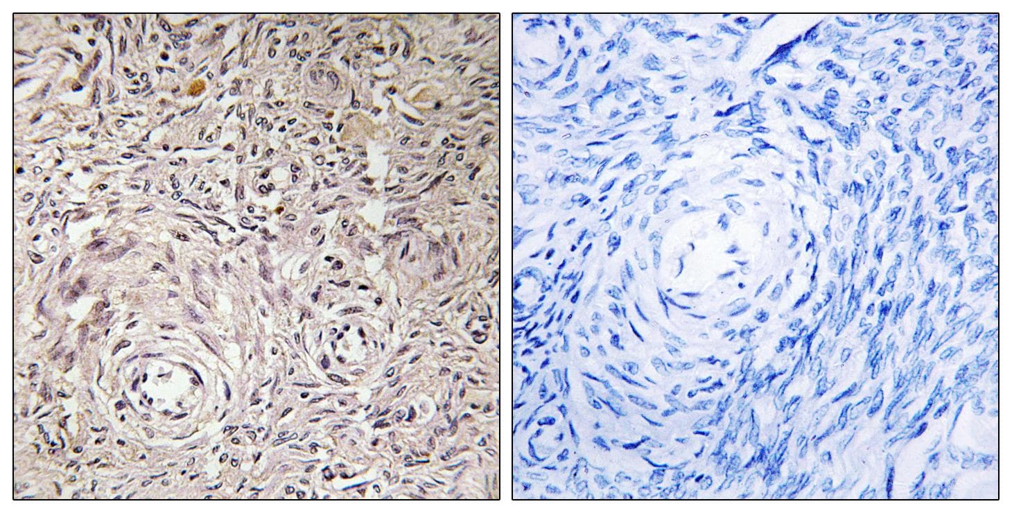 GCNT7 Antibody