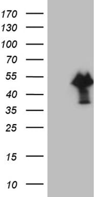 FOXP3 Antibody (clone OTI6B10, Carrier-free)