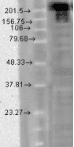Monoclonal Mouse anti-Human SCN9A / Nav1.7 Antibody (clone S68-6, IHC, WB)