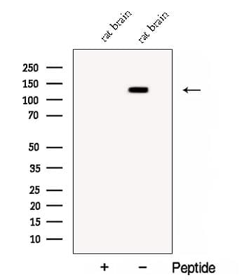 Polyclonal Rabbit anti-Human CNTN1 / gp135 / Contactin 1 Antibody (WB)