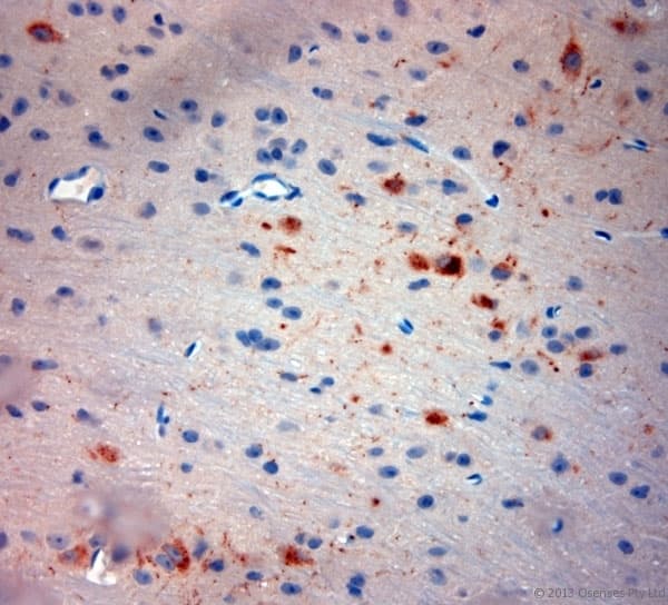 TACR1 / NK1R Antibody (aa150-200)