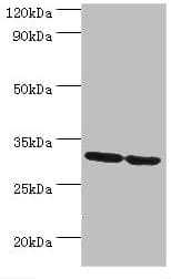 Polyclonal Rabbit anti-Human PNP / Nucleoside Phosphorylase Antibody (aa1-289, IHC, WB)