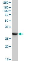 CBR3 Antibody (clone 1G8)