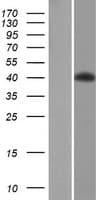 Human CTB / PCYT1B Protein (Over-Expression Lysate Myc-DDK (Flag))
