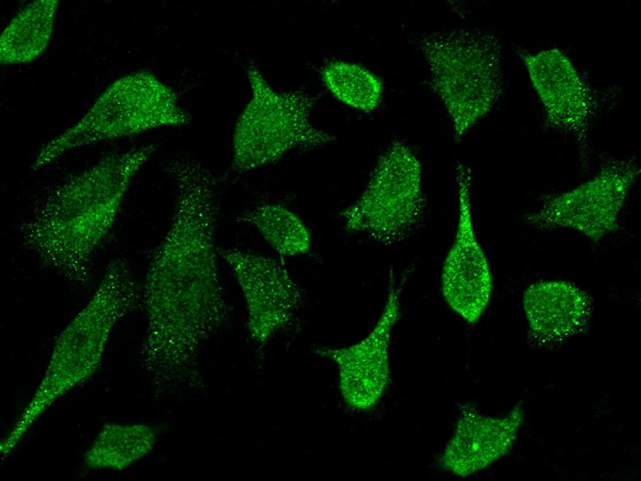 Polyclonal Rabbit anti-Human PRKD2 / PKD2 Antibody (Preservative Free, IF, WB)