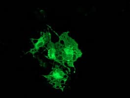 PRKCE / PKC-Epsilon Antibody (clone OTI2A12)