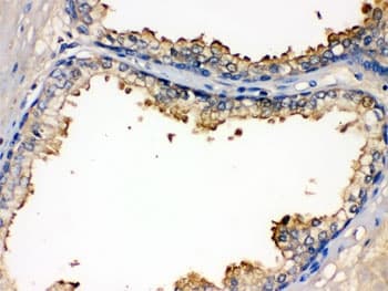 ALK-6 / BMPR1B Antibody