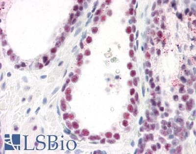 IHC-plus™ Polyclonal Rabbit anti-Human SARNP / Hcc-1 / CIP29 Antibody (aa4-210, IHC, IF, WB)