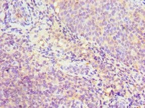 SRSF4 / SFRS4 Antibody (aa1-180)