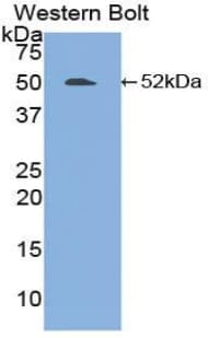 FGL2 Antibody (aa24-439, PE)