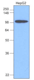 IHC-plus™ HK1 / Hexokinase 1 Antibody (aa1-917, clone 4D7)