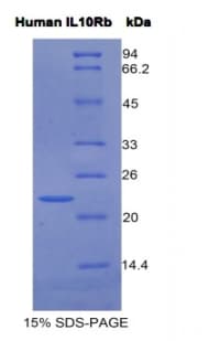 Human IL10RB Protein (Recombinant His)