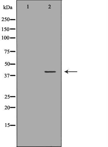 HMBS / PBGD Antibody