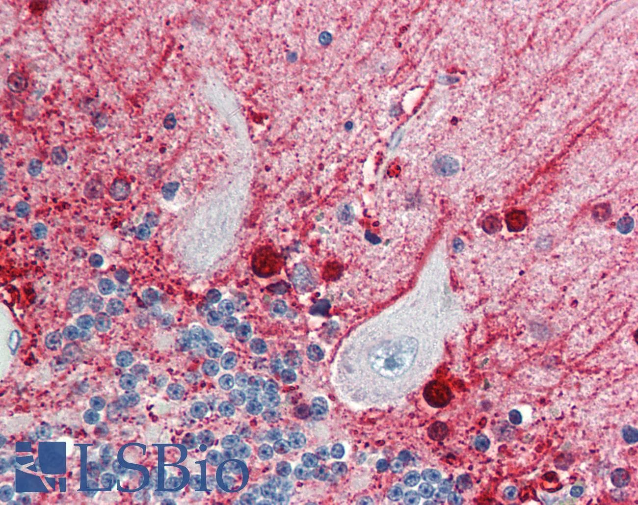 IHC-plus™ CASP5 / Caspase 5 Antibody
