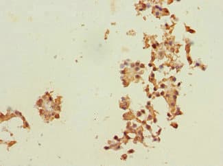 Polyclonal Rabbit anti-Human RPN2 / Ribophorin II Antibody (IHC, WB)