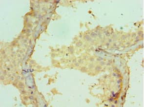 CRISP2 / TSP1 Antibody (aa22-243)