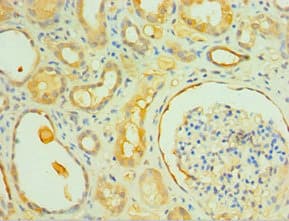IL1R1 Antibody (aa18-320)