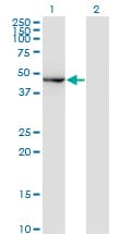 IHC-plus™ Monoclonal Mouse anti-Human MAPK8 / JNK1 Antibody (clone 2F3, IHC, WB)
