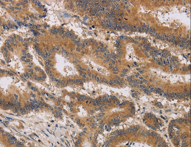 ITIH1 Antibody