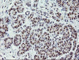 ZBED1 / TRAMP Antibody (clone OTI1F7)