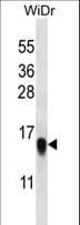 RPL35 / Ribosomal Protein L35 Antibody (aa86-115)