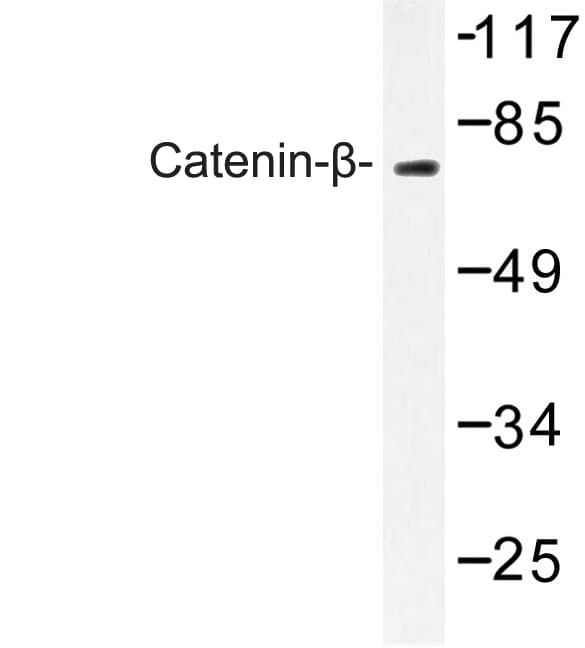 Polyclonal Rabbit anti-Human CTNNB1 / Beta Catenin Antibody (Gly650, IHC, IF, WB)