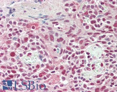 IHC-plus™ RAD18 Antibody (clone 3H7)
