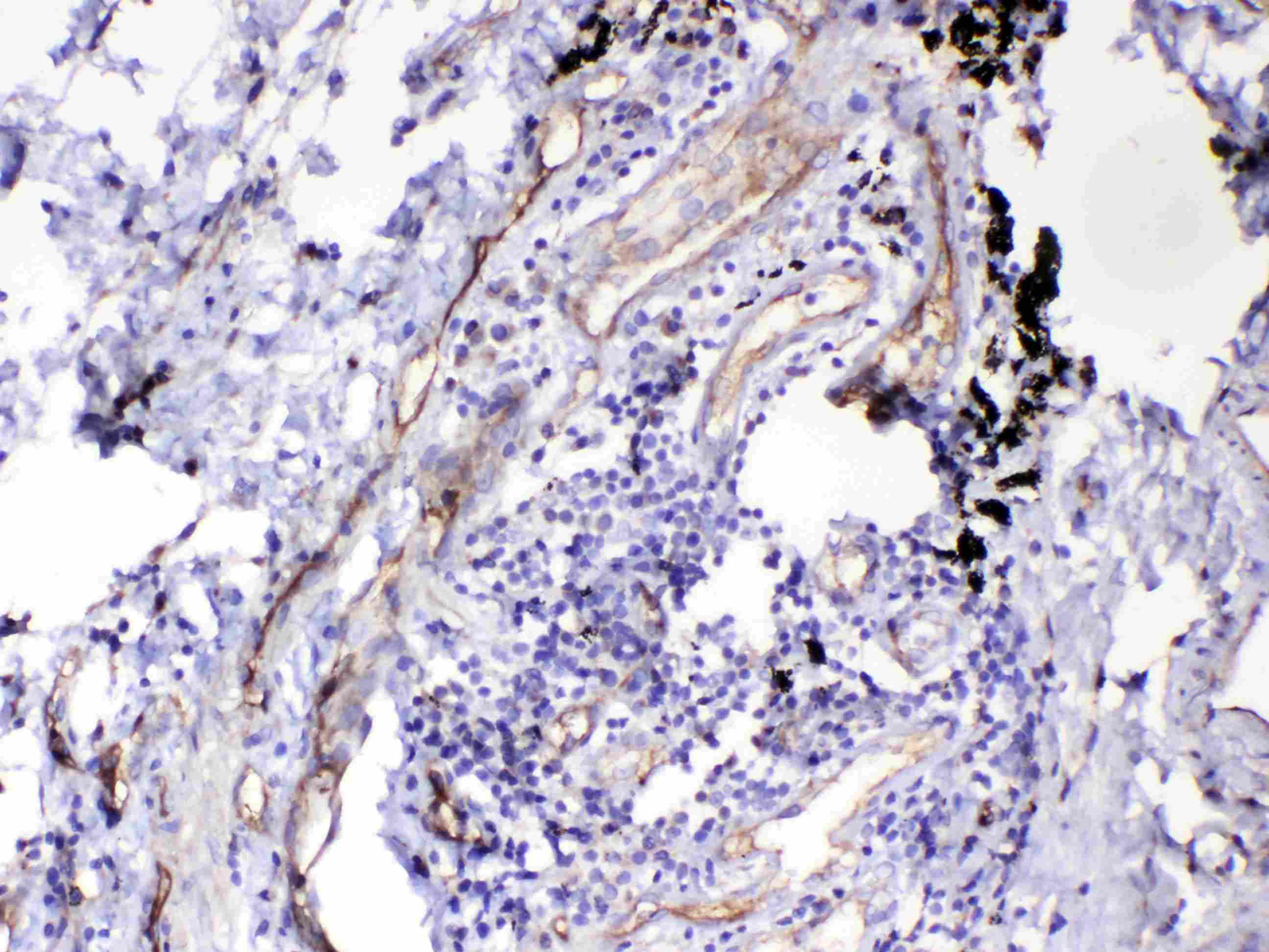 HOMER3 / Homer 3 Antibody