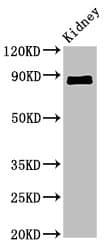 Polyclonal Rabbit anti-Human CDH18 / Ey-Cadherin Antibody (IHC, IF, WB)