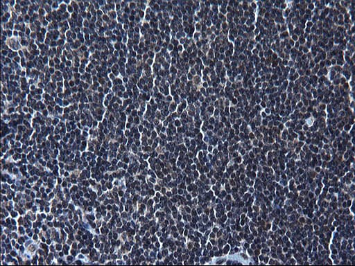 ZFAND3 / TEX27 Antibody (clone OTI1H10)