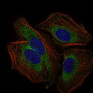 CD59 Antibody (Amino Acid: 31-111, clone 8D2B8)