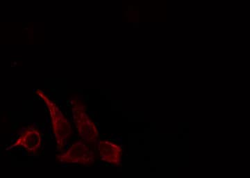CD28 Antibody (phospho-Tyr218)