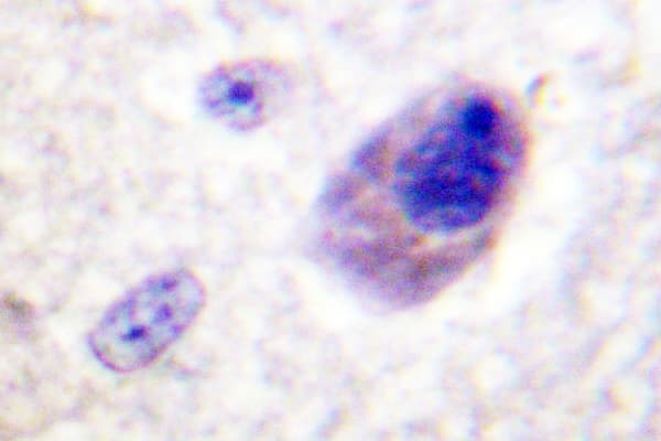BAD Antibody (Pro130)