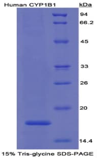 Human CYP1B1 Protein (Recombinant His)