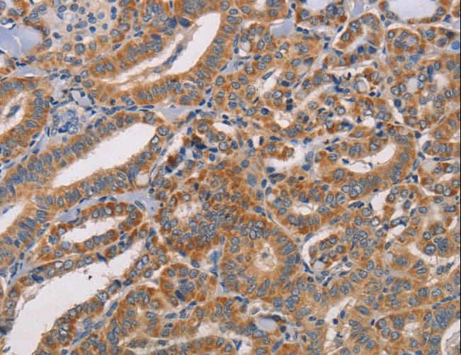 CDK11A + CDK11B Antibody